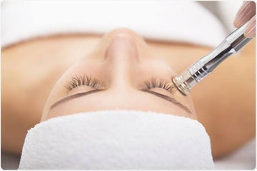 Express Microdermabrasion